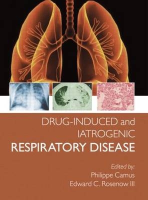 Drug-induced and Iatrogenic Respiratory Disease -  Phillipe Camus,  Edward Rosenow III