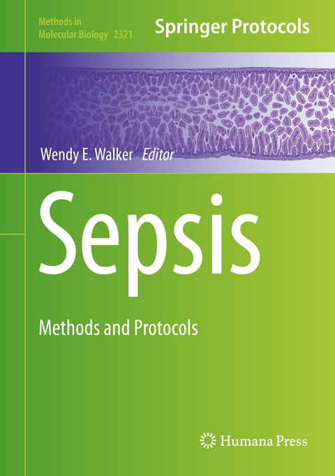 Sepsis - 