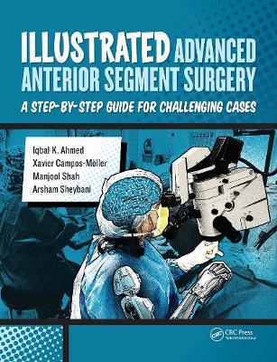 Illustrated Advanced Anterior Segment Surgery - Iqbal Ahmed, Xavier Möller, Manjool Shah, Arsham Sheybani