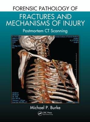 Forensic Pathology of Fractures and Mechanisms of Injury -  Michael P. Burke