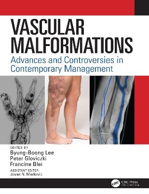 Vascular Malformations - 