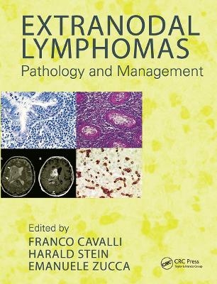 Extranodal Lymphomas - 