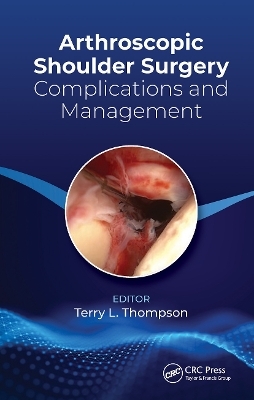 Arthroscopic Shoulder Surgery - Terry Thompson