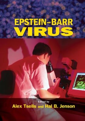 Epstein-Barr Virus - 