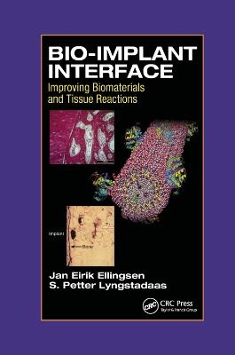 Bio-Implant Interface - J.E. Ellingsen, S.P. Lyngstadaas