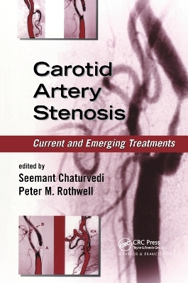 Carotid Artery Stenosis - 