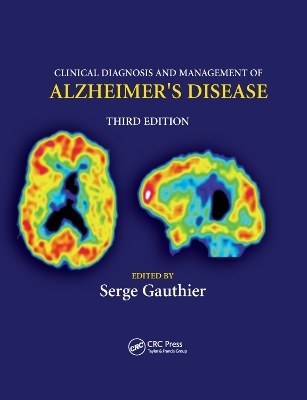 Clinical Diagnosis and Management of Alzheimer's Disease - 