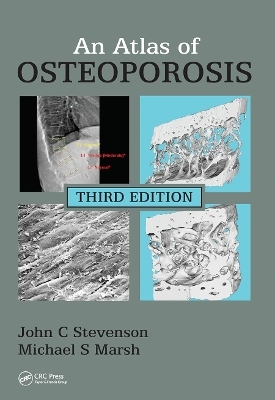 An Atlas of Osteoporosis - John C. Stevenson, Michael S. Marsh