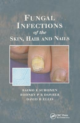 Fungal Infections of the Skin and Nails - Raimo E. Suhonen, Rodney P.R. Dawber, David H. Ellis