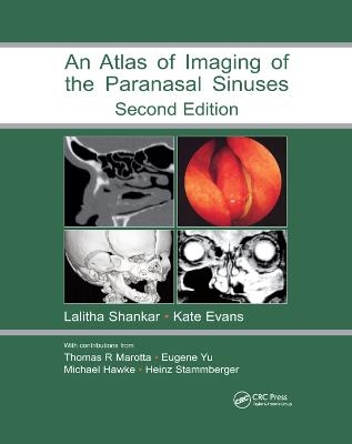 Atlas of Imaging of the Paranasal Sinuses, Second Edition - 