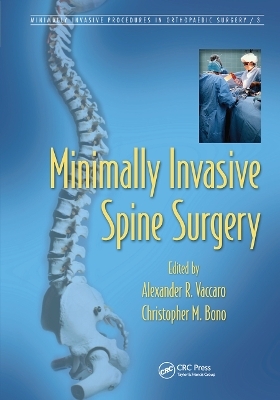 Minimally Invasive Spine Surgery - 