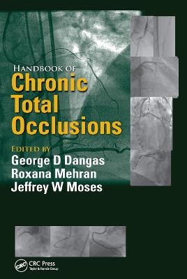 Handbook of Chronic Total Occlusions - 