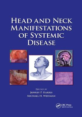 Head and Neck Manifestations of Systemic Disease - 