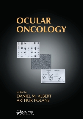 Ocular Oncology - 