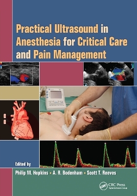 Practical Ultrasound in Anesthesia for Critical Care and Pain Management - 