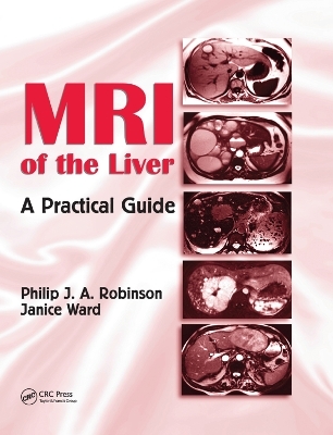 MRI of the Liver - Philip J. A. Robinson, Janice Ward