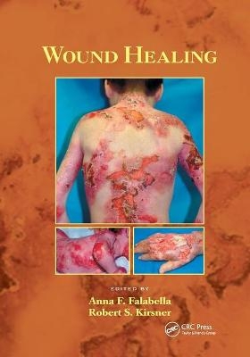 Wound Healing - 