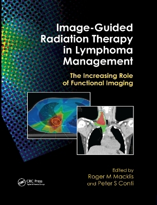 Image-Guided Radiation Therapy in Lymphoma Management - 