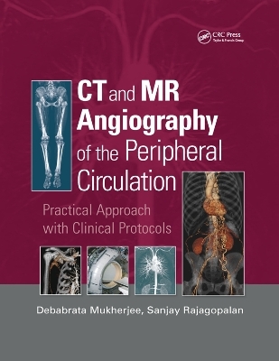 CT and MR Angiography of the Peripheral Circulation - 