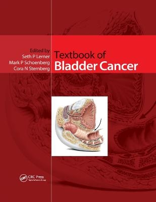 Textbook of Bladder Cancer - 