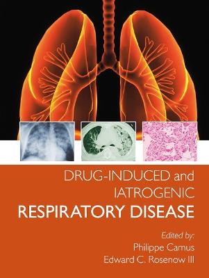 Drug-induced and Iatrogenic Respiratory Disease - Phillipe Camus, Edward Rosenow III