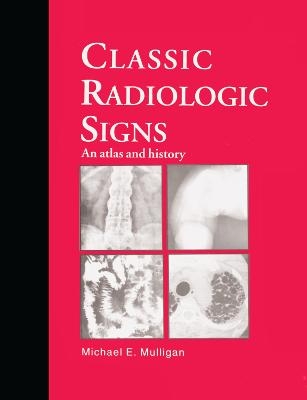 Classic Radiologic Signs - M.E. Mulligan