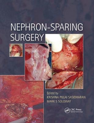 Nephron-Sparing Surgery - 