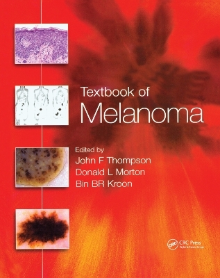 Textbook of Melanoma - 