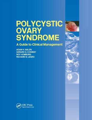 Polycystic Ovary Syndrome - 