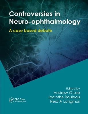 Controversies in Neuro-Ophthalmology - 