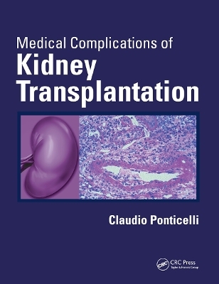 Medical Complications of Kidney Transplantation - 