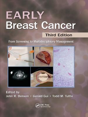 Early Breast Cancer - 