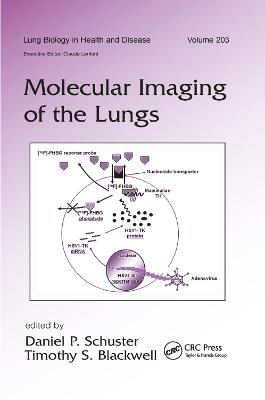 Molecular Imaging of the Lungs - 