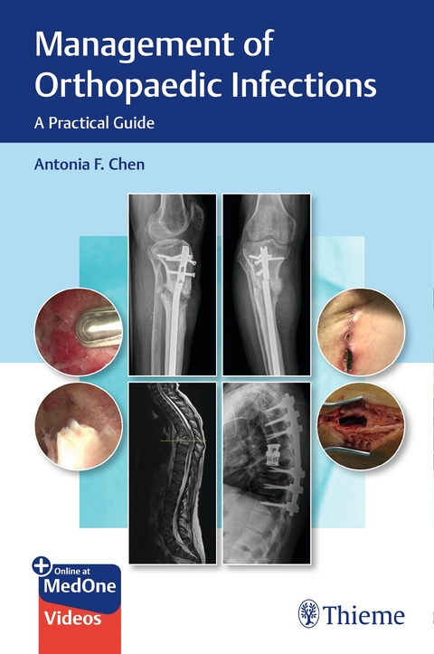 Management of Orthopaedic Infections - Antonia Chen