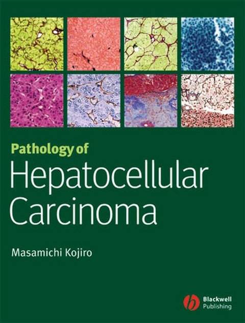 Pathology of Hepatocellular Carcinoma - Masamichi Kojiro