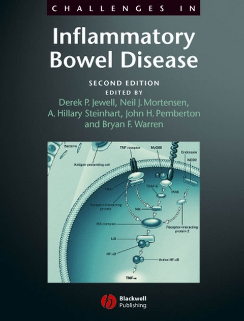 Challenges in Inflammatory Bowel Disease - 