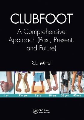 Clubfoot - R. L. Mittal