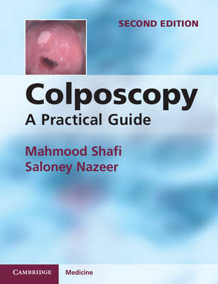 Colposcopy -  Saloney Nazeer,  Mahmood Shafi