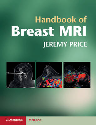 Handbook of Breast MRI -  Jeremy Price