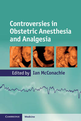 Controversies in Obstetric Anesthesia and Analgesia - 