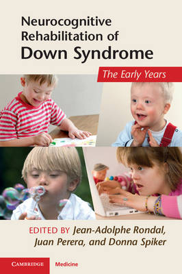 Neurocognitive Rehabilitation of Down Syndrome - 