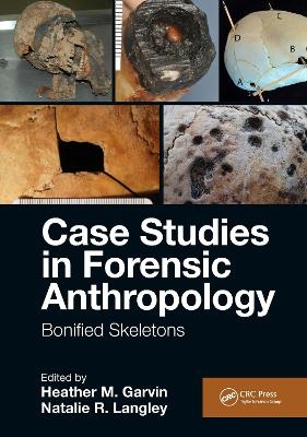 Case Studies in Forensic Anthropology - 