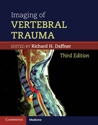 Imaging of Vertebral Trauma -  Richard H. Daffner