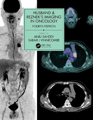 Husband & Reznek's Imaging in Oncology - 