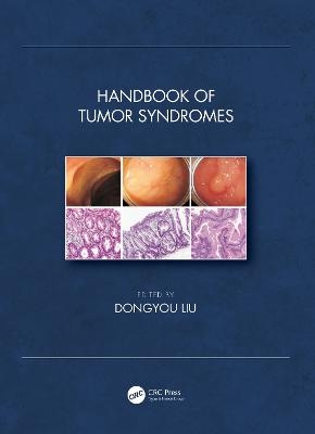 Handbook of Tumor Syndromes - 