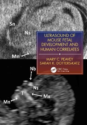 Ultrasound of Mouse Fetal Development and Human Correlates - Mary C. Peavey, Sarah K. Dotters-Katz