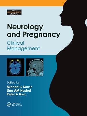 Neurology and Pregnancy - 