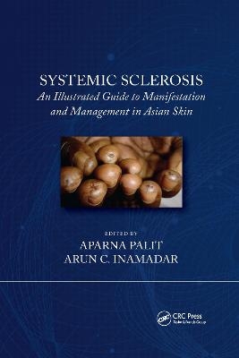 Systemic Sclerosis - 