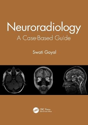 Neuroradiology - Swati Goyal