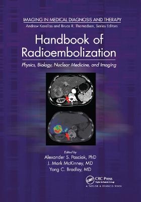 Handbook of Radioembolization - 